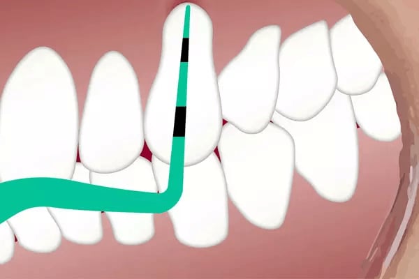 Diş Eti Hastalıkları- Medikament Ağız ve Diş Sağlığı Polikliniği