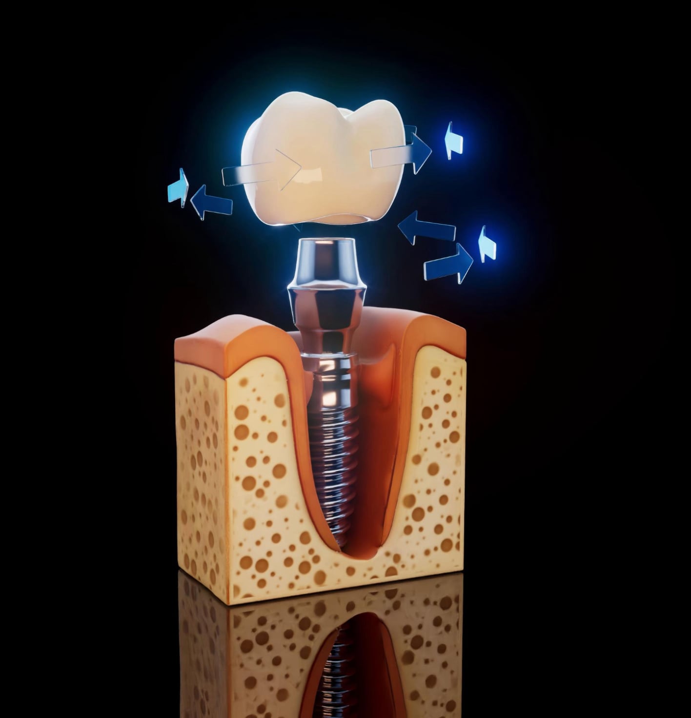 İmplant Uygulamaları | Medikament Ağız ve Diş Sağlığı Polikliniği